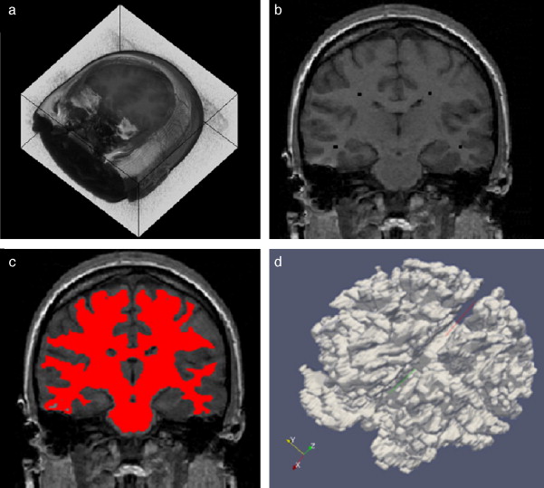 Segmentación de materia blanca empleando Region Growing en IRM del cerebro. (a) ...
