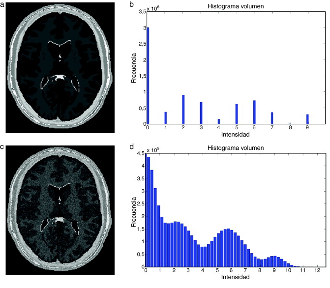 Adición de ruido aditivo a imágen de phantom de IRM del cerebro. (a) Corte axial ...