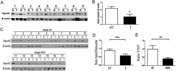 Lower apolipoprotein A1 (ApoA1) expression in the tissues of (A, B) gastric ...